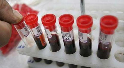 Pulsuz dərmanla təmin edilən hepatitli xəstələrin sayı -