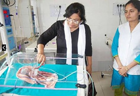 Dörd əli və dörd ayağı olan uşaq doğuldu -