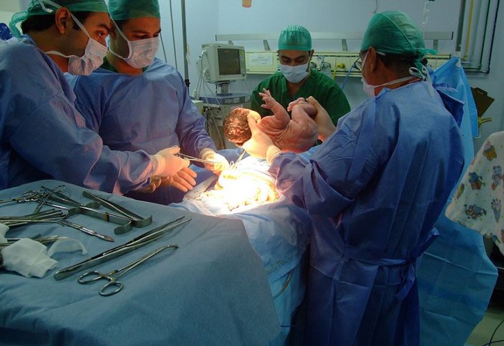 Qeysəriyyə əməliyyatı ilə dünyaya gələn körpələr haqqında