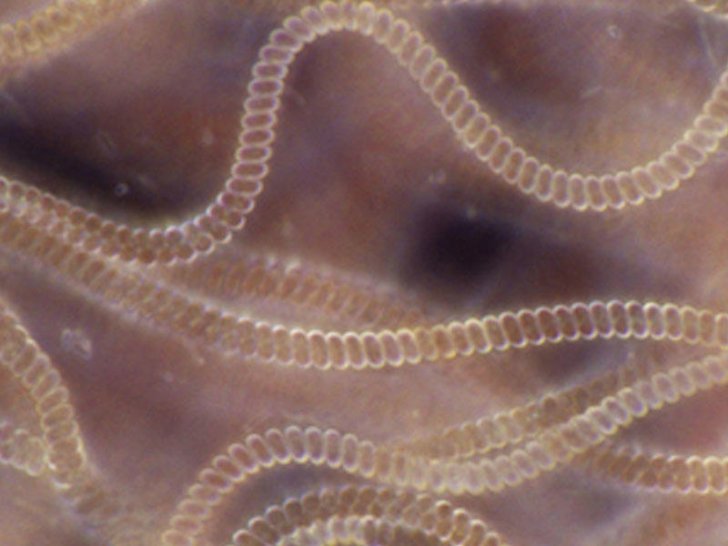 Nanorobotlar xəstəliyə diaqnoz qoyacaq