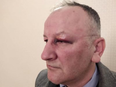 Polis Mustafa Hacıbəylidən döyülmə faktını təkzib etməyi tələb edir Polis Mustafa Hacıbəylidən döyülmə faktını təkzib etməyi tələb edir