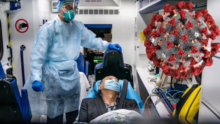 Koronavirus insanın ağciyərlərini bu hala salır -
