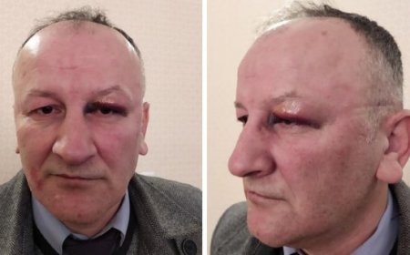 Polis Mustafa Hacıbəylidən döyülmə faktını təkzib etməyi tələb edir