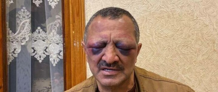 Tofiq Yaqublunun işgəncə şikayəti ilə bağlı QƏRAR